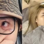 雪碧自曝提眼手术过度致双眼无法闭合引发粉丝震惊热议