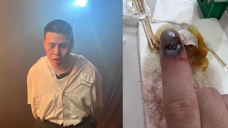 閩南狼發文透露手指骨折仍表達救災決心不能身赴花蓮但全力後援