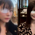 前男友暴打致独眼龙松本麗鈴揭露家暴真相與往昔痛苦的回憶