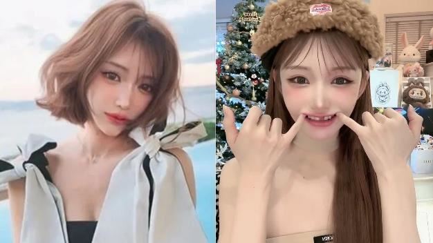 明日花綺羅全麻手術意外致門牙斷裂，直播自白真相引發網友熱議